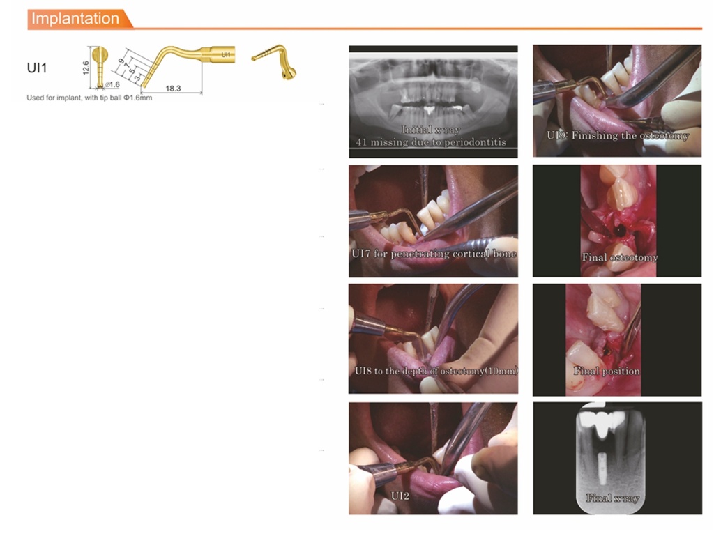 Piezo surgery led Motor quirúrgico Surgery-X - DTE
