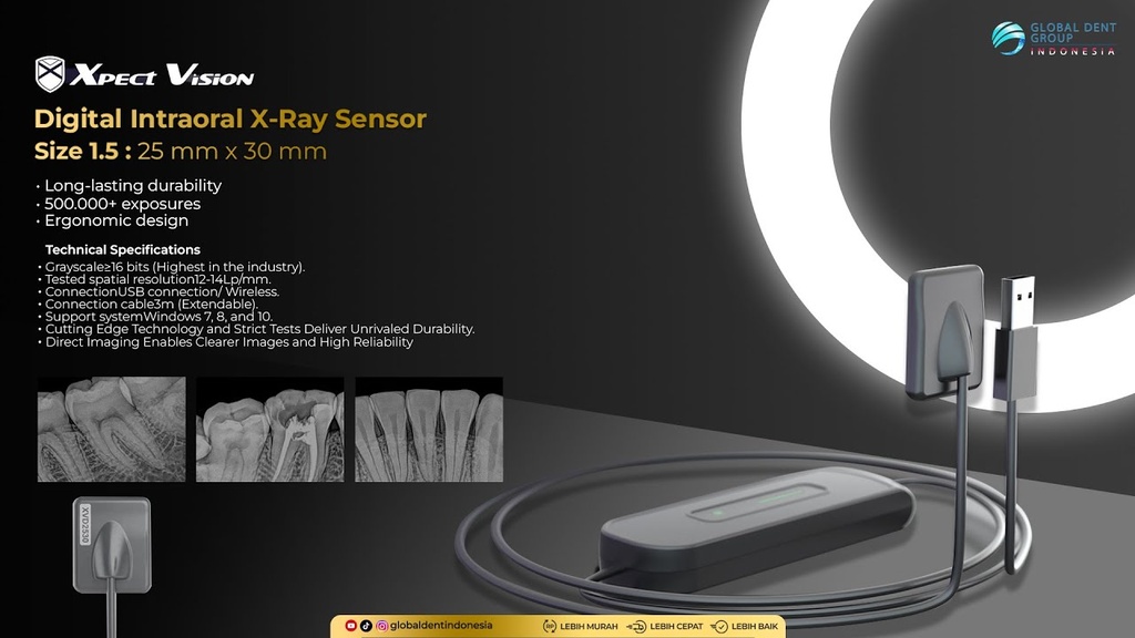 Radiovisiografo RVG XVD2530 (incluye posicionador) - Xpect Vision
