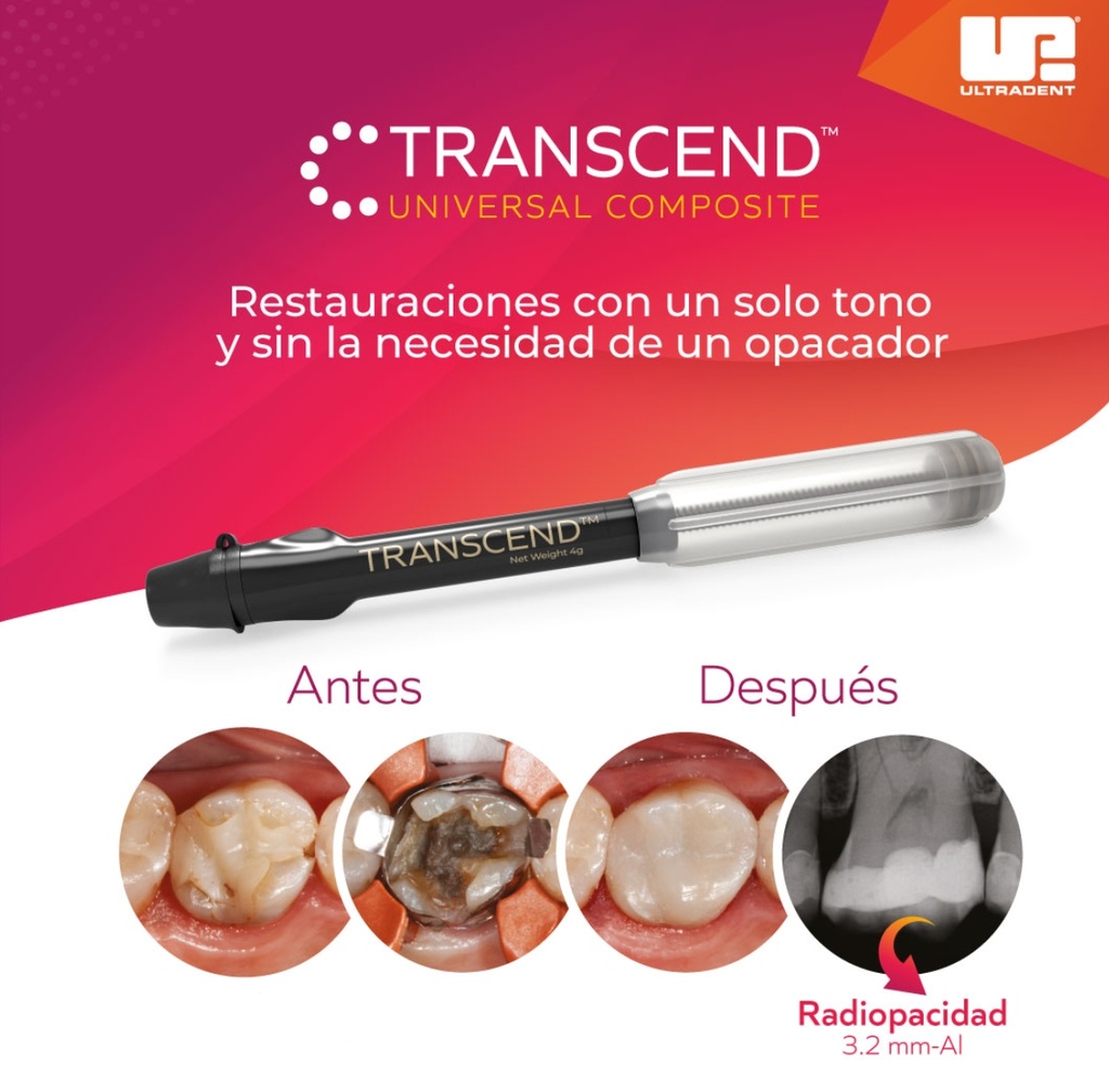 Kit de Composite / resinas  Transcend - 7 jeringas  de 4g c/u - Ultradent