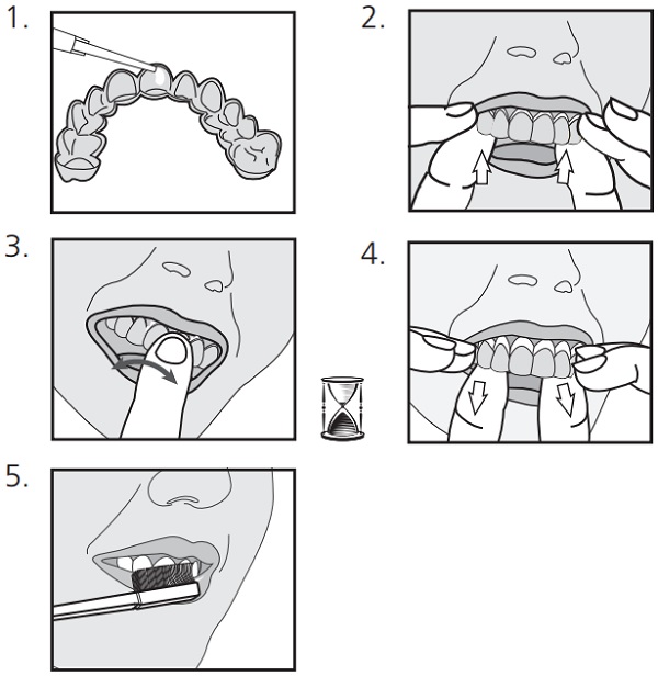 Blanqueador Opalescence - PF Regular - Ambulatorio - 12 un - Carbamida - ULTRADENT