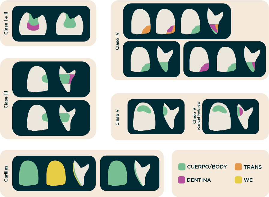 Kit composite Elora APS  - FGM 